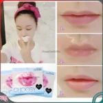 Mặt nạ môi Choosy dưỡng ẩm, trị thâm, làm hồng môi - Ảnh 3