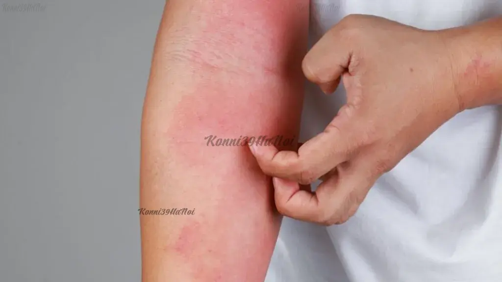 Người có cơ địa quá nhạy cảm, dễ bị dị ứng không nên sử dụng tảo xoắn Nhật Bản.