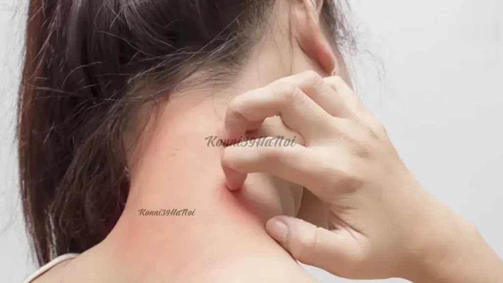 Người có cơ địa bị dị ứng không nên sử dụng Glucosamine