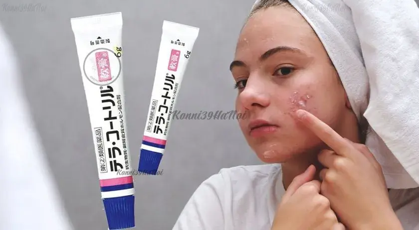 Kem trị mụn Tera Kotoriru nội địa Nhật