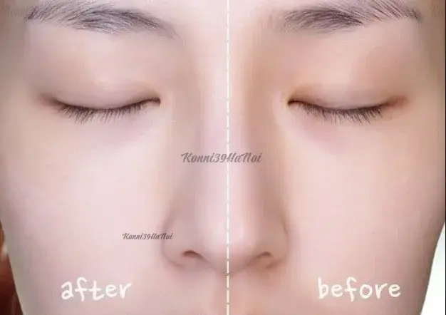 Hình ảnh làn da sau và trước khi sử dụng kem chống nắng Aqua UV Essence