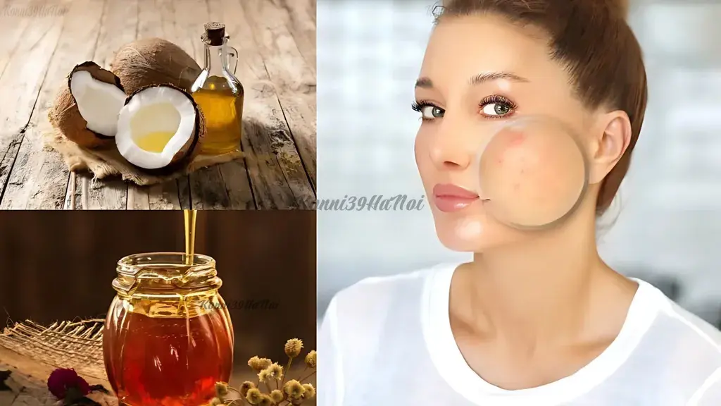 Trị nẻ da tại nhà bằng dầu dừa và mật ong