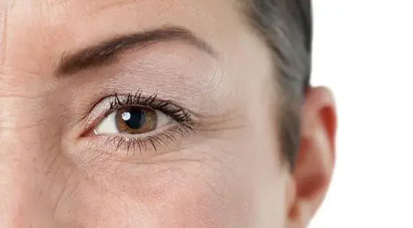 sql8t3q3ks dấu hiệu lão hóa trên mắt